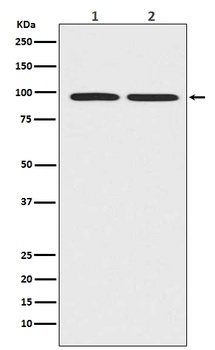 Anti-beta Catenin CTNNB1 Rabbit Monoclonal Antibody