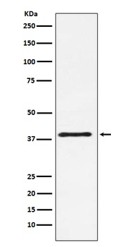 CTLA4 (CD152) Monoclonal Antibody