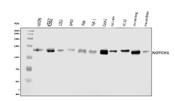 Anti-Notch1 Monoclonal Antibody