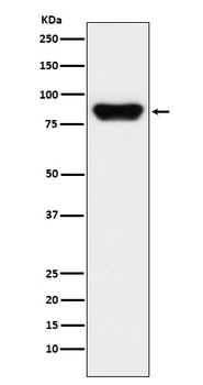 Anti-Prothrombin F2 Monoclonal Antibody