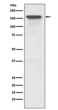 Anti-P Glycoprotein ABCB1 Rabbit Monoclonal Antibody