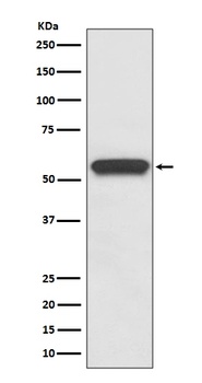 Aromatase CYP19A1 Rabbit Monoclonal Antibody