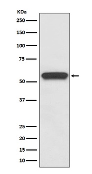 Anti-Aromatase CYP19A1 Rabbit Monoclonal Antibody