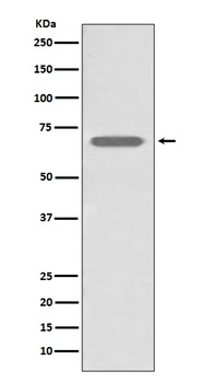 beta 2 Adrenergic Receptor ADRB2 Rabbit Monoclonal Antibody