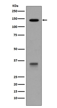 LDL Receptor Rabbit Monoclonal Antibody
