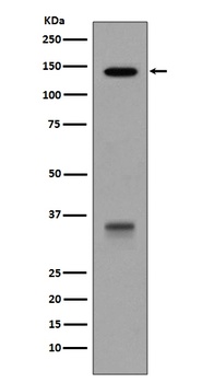 Anti-LDL Receptor Rabbit Monoclonal Antibody