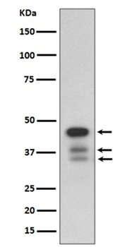 cleaved Caspase-9 CASP9 Rabbit Monoclonal Antibody