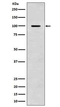 Amyloid beta A4 APP Rabbit Monoclonal Antibody