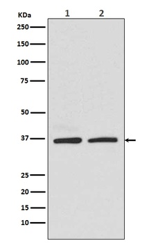 Rad51 Rabbit Monoclonal Antibody