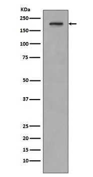 Anti-PDGF Receptor beta PDGFRB Rabbit Monoclonal Antibody