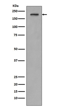 PDGF Receptor beta PDGFRB Rabbit Monoclonal Antibody