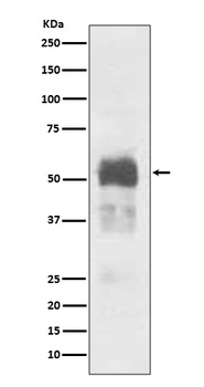 Tau MAPT Rabbit Monoclonal Antibody