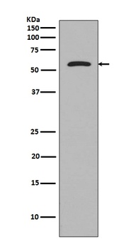 Tau MAPT Rabbit Monoclonal Antibody