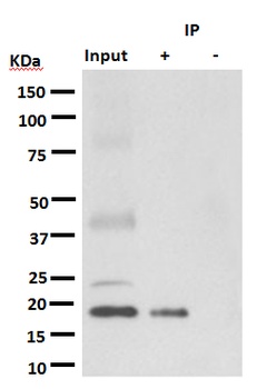 KRAS+HRAS+NRAS Rabbit Monoclonal Antibody