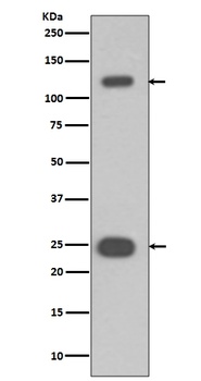 Anti-PARP PARP1 Rabbit Monoclonal Antibody