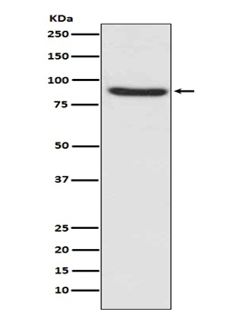 MLH1 Rabbit Monoclonal Antibody