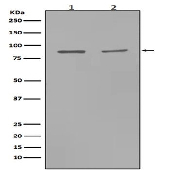 MMP9 Rabbit Monoclonal Antibody