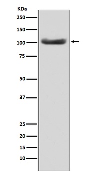 MSH2 Monoclonal Antibody