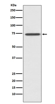 RIP RIPK1 Rabbit Monoclonal Antibody