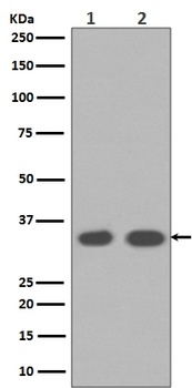 Cyclin D1 CCND1 Rabbit Monoclonal Antibody