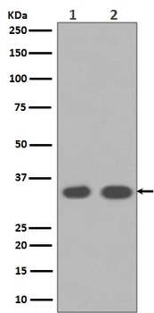Anti-Cyclin D1 CCND1 Rabbit Monoclonal Antibody