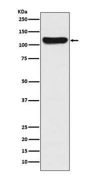 Anti-FAK PTK2 Rabbit Monoclonal Antibody