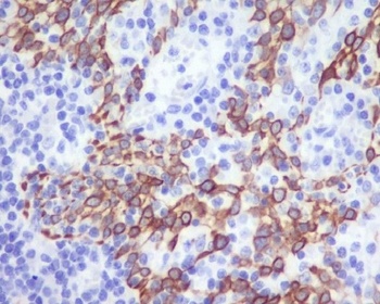 Anti-CCR2/CKR2 Rabbit Monoclonal Antibody