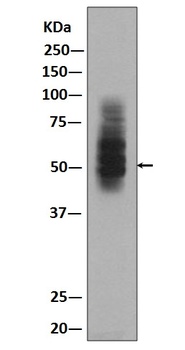 GLUT1 SLC2A1 Rabbit Monoclonal Antibody