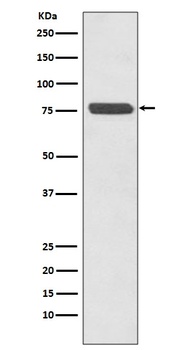 p63 TP63 Rabbit Monoclonal Antibody