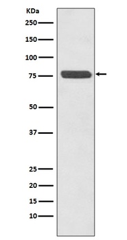 Anti-p63 TP63 Rabbit Monoclonal Antibody