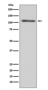 C3/Complement C3 Rabbit Monoclonal Antibody