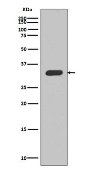 Anti-p27 KIP 1 CDKN1B Rabbit Monoclonal Antibody