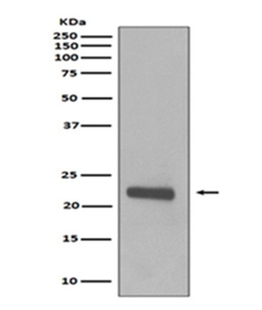 Anti-Caveolin-1 CAV1 Rabbit Monoclonal Antibody