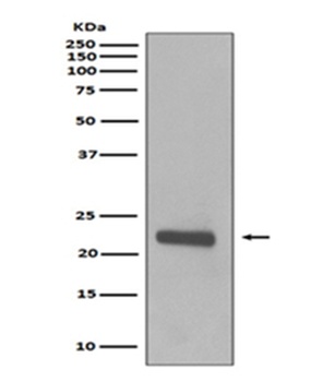 Caveolin-1 CAV1 Rabbit Monoclonal Antibody