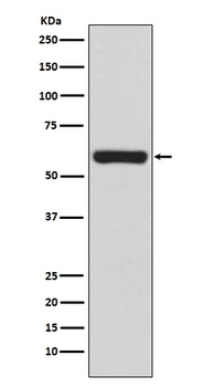 TRAF6 Rabbit Monoclonal Antibody