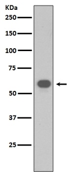 TRAF6 Rabbit Monoclonal Antibody