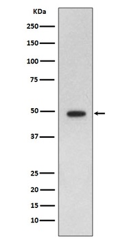 GFAP Rabbit Monoclonal Antibody