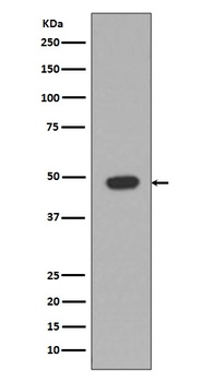 Anti-GFAP Rabbit Monoclonal Antibody