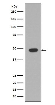 GFAP Rabbit Monoclonal Antibody