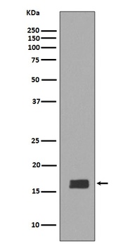 alpha + beta Synuclein SNCA Rabbit Monoclonal Antibody