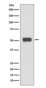 ATG5/Apg5 Rabbit Monoclonal Antibody