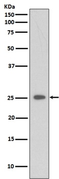 C Reactive Protein CRP Rabbit Monoclonal Antibody