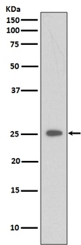 Anti-C Reactive Protein CRP Rabbit Monoclonal Antibody
