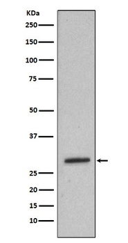Heme Oxygenase 1 HMOX1 Rabbit Monoclonal Antibody