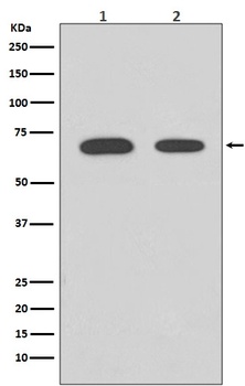 Anti-Chk2 CHEK2 Rabbit Monoclonal Antibody