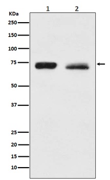 Anti-NF2 / Merlin Monoclonal Antibody