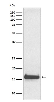 TTR/Prealbumin Rabbit Monoclonal Antibody