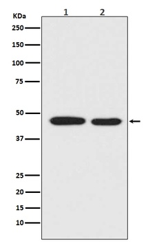 Anti-MEK1 MAP2K1 Rabbit Monoclonal Antibody
