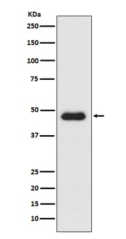 Anti-CXCR3 Monoclonal Antibody