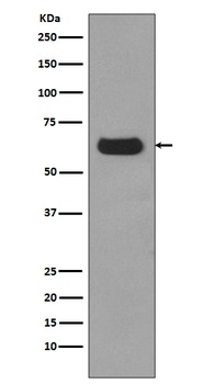 p62/SQSTM1 Rabbit Monoclonal Antibody